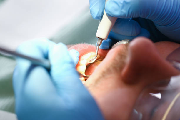 Best Emergency Denture Repair in Redmond, WA