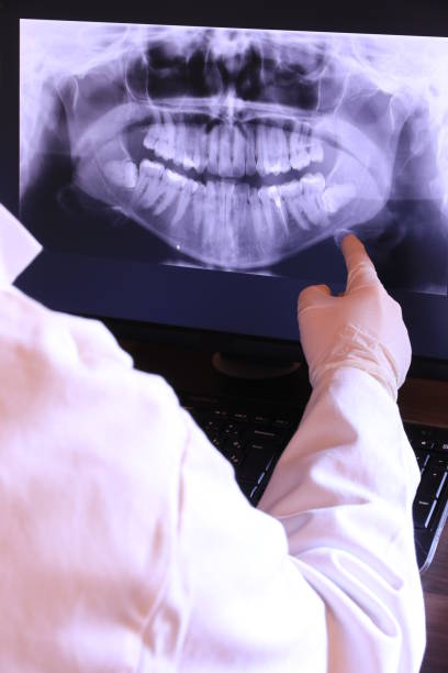 Best Emergency Treatment for Dental Infections or Abscesses in Redmond, WA
